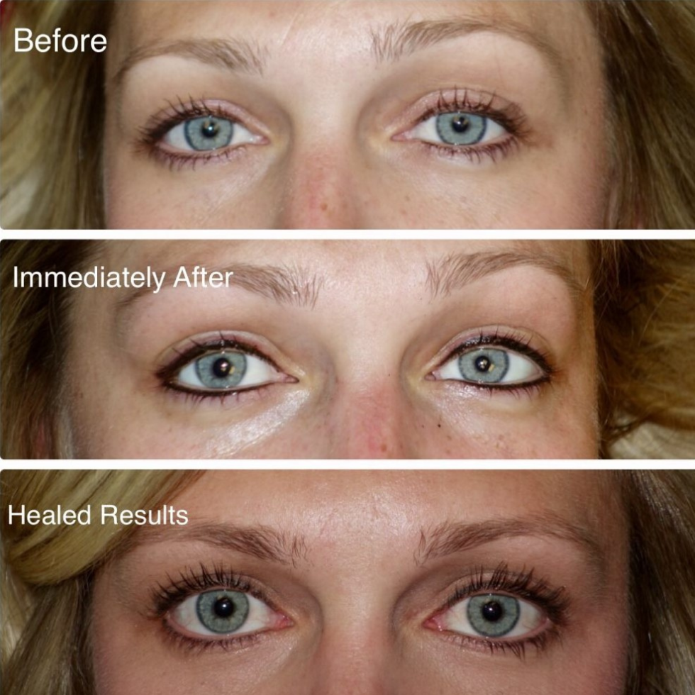 Eye Enhancements Permanent Cosmetics by Tina Pinz Boise, Idaho